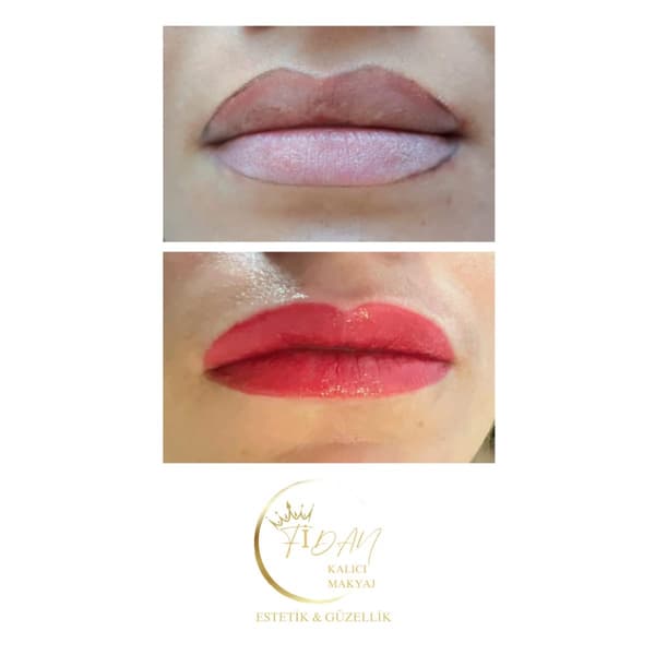 Fidan Kalıcı Makyaj Estetik Güzellik - 12. Fotoğraf Fidan Kalıcı Makyaj Estetik Güzellik - 12. Fotoğraf