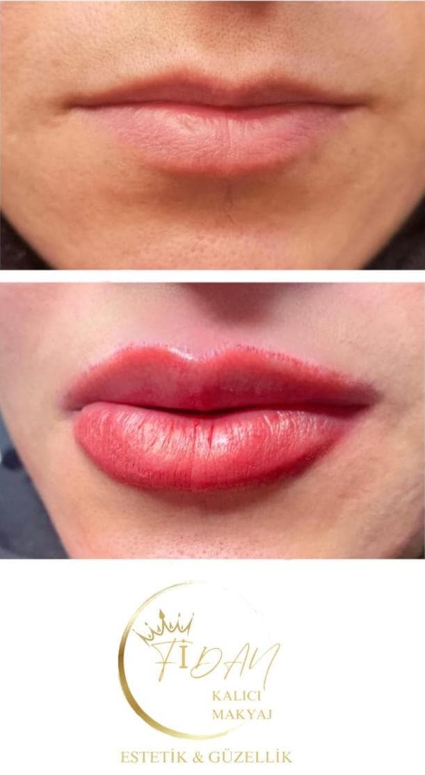 Fidan Kalıcı Makyaj Estetik Güzellik