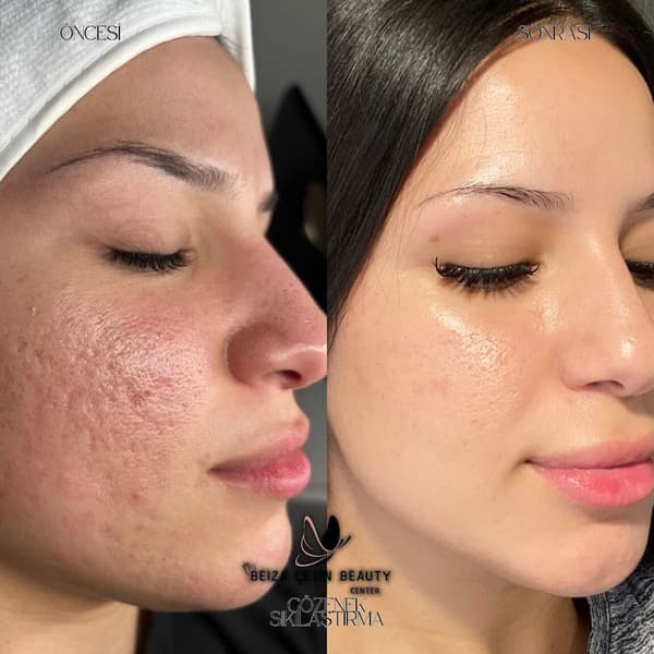 Beiza Çetin Beauty Center - 2. Fotoğraf Beiza Çetin Beauty Center - 2. Fotoğraf