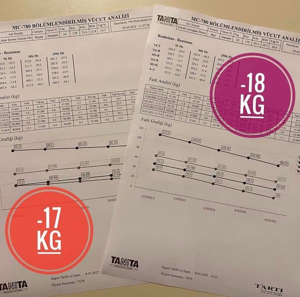 Uzman Dyt. Cansu Özçelik - 5. Fotoğraf Uzman Dyt. Cansu Özçelik - 5. Fotoğraf