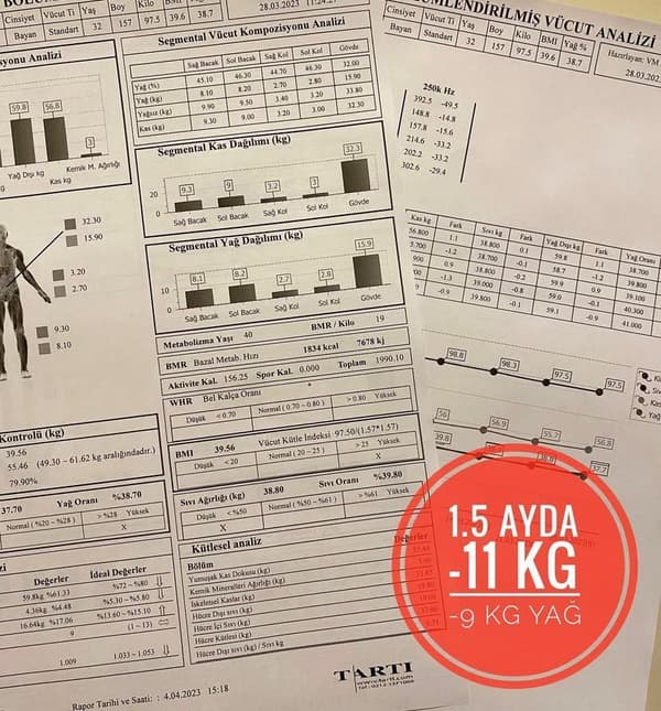 Uzman Dyt. Cansu Özçelik - 2. Fotoğraf Uzman Dyt. Cansu Özçelik - 2. Fotoğraf