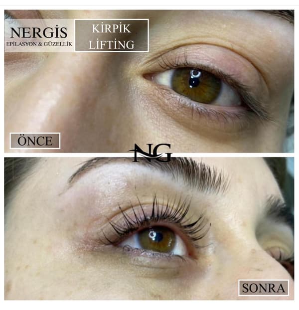 Nergis Epilasyon ve Güzellik - 4. Fotoğraf Nergis Epilasyon ve Güzellik - 4. Fotoğraf