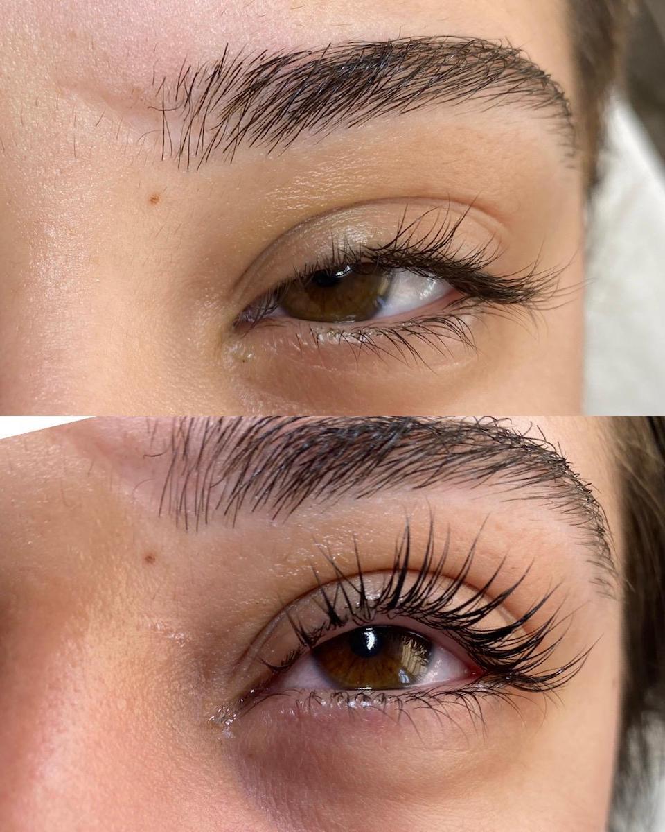 Nergis Epilasyon ve Güzellik