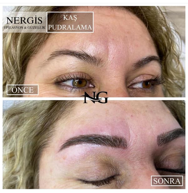 Nergis Epilasyon ve Güzellik - 16. Fotoğraf Nergis Epilasyon ve Güzellik - 16. Fotoğraf