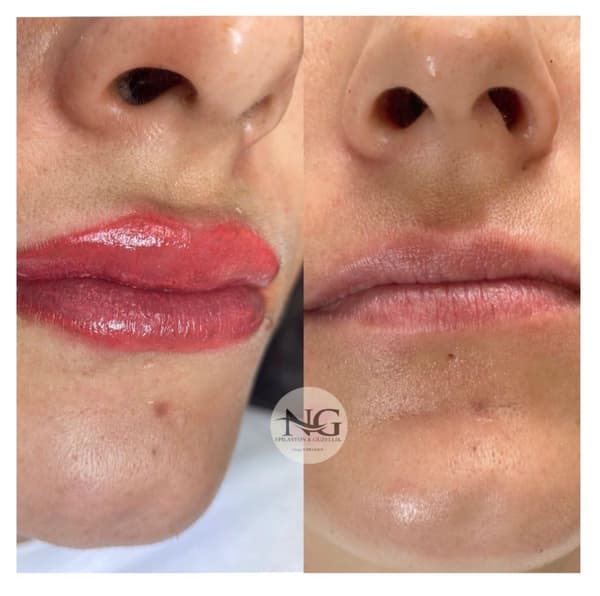 Nergis Epilasyon ve Güzellik - 5. Fotoğraf Nergis Epilasyon ve Güzellik - 5. Fotoğraf