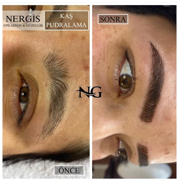 Nergis Epilasyon ve Güzellik - 15. Fotoğraf Nergis Epilasyon ve Güzellik - 15. Fotoğraf