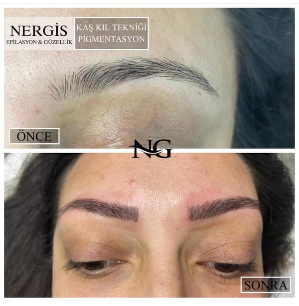 Nergis Epilasyon ve Güzellik - 13. Fotoğraf Nergis Epilasyon ve Güzellik - 13. Fotoğraf