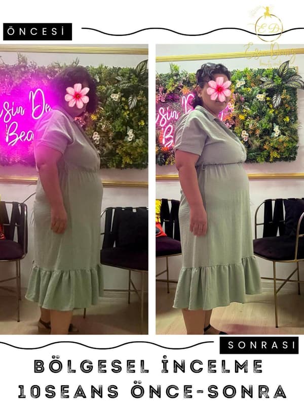 Esin Deniz Beauty - 12. Fotoğraf Esin Deniz Beauty - 12. Fotoğraf