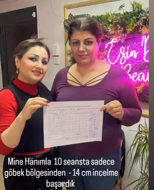 Esin Deniz Beauty - 9. Fotoğraf Esin Deniz Beauty - 9. Fotoğraf