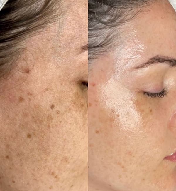 Rukiye Kuba Güzellik Salonu  - 9. Fotoğraf